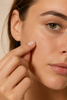 How Do I Get Rid of a Pimple Overnight?
