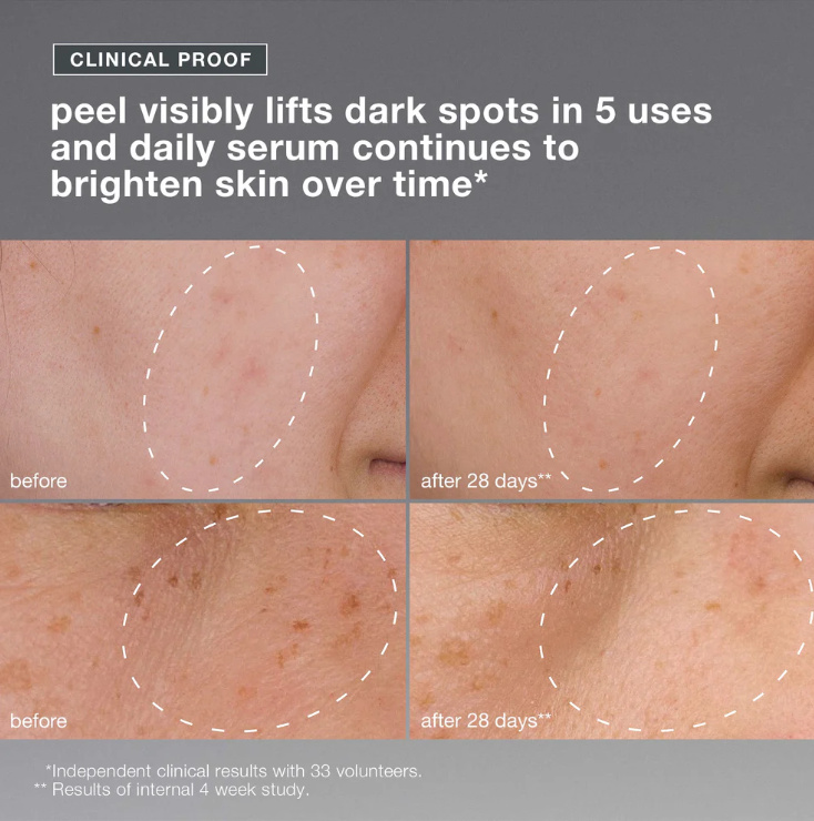 powerbright dark spot system