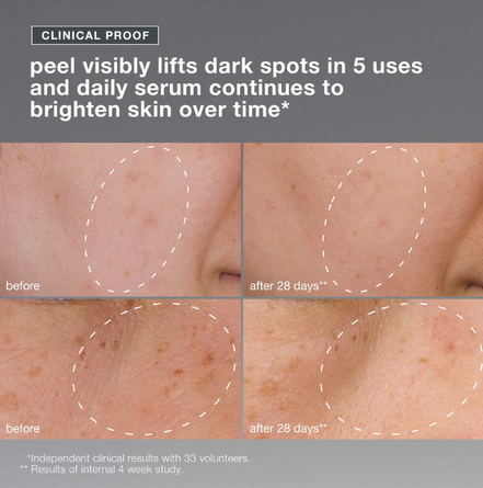 powerbright dark spot system