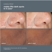 PowerBright Dark Spot Peel