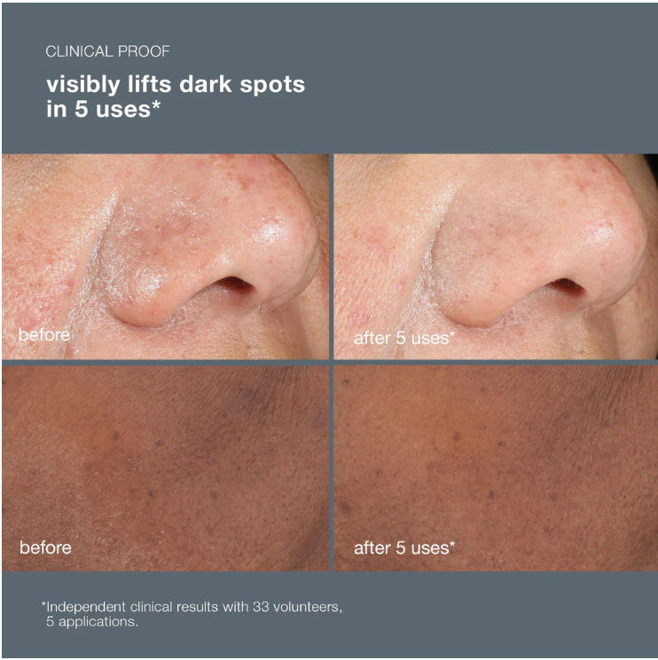 PowerBright Dark Spot Peel
