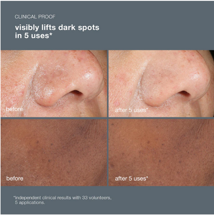 PowerBright Dark Spot Peel