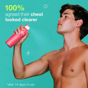 Clarifying Bacne Spray