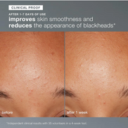 daily microfoliant exfoliator