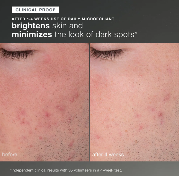 discover healthy skin kit